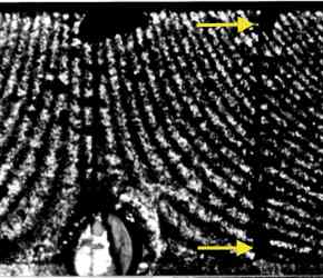 classical hologram of deformation